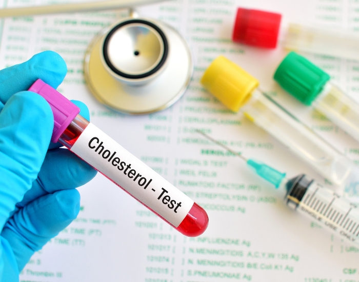 How to Lower Cholesterol Fast