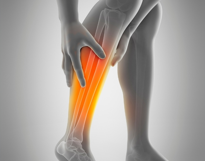 ankle-brachial index test what is an ABI test