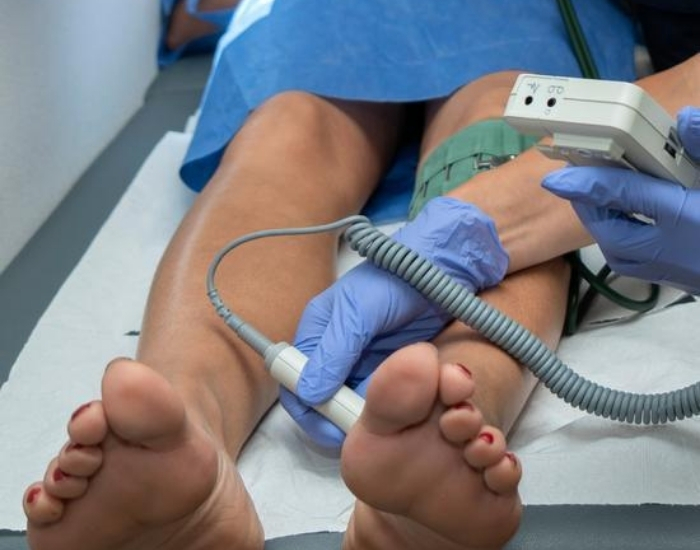 numb toes poor circulation poor circulation symptoms